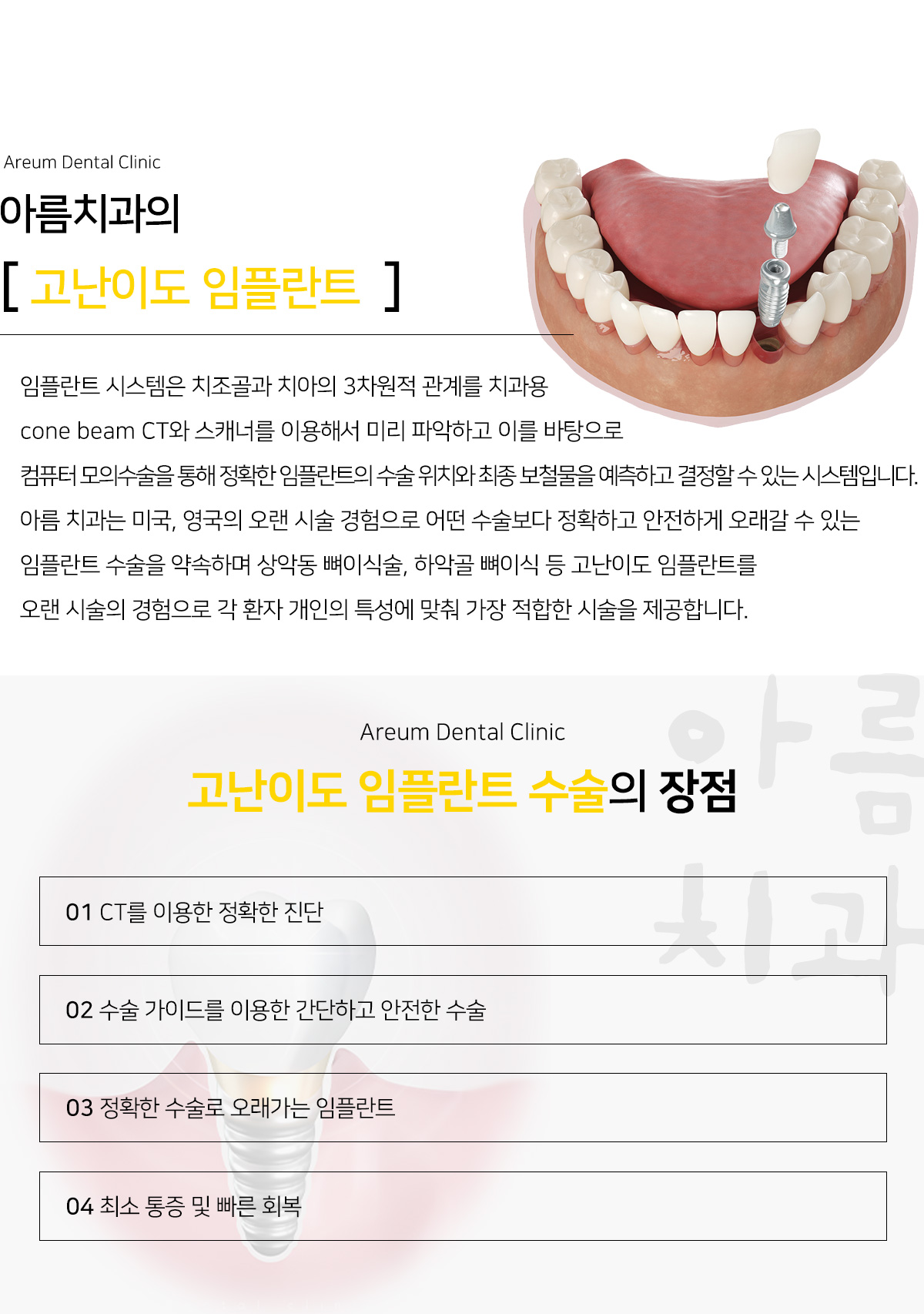 고난이도 임플란트